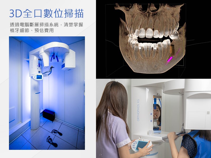 3D全口數位掃描│透過電腦斷層掃描系統,清楚掌握植牙細節、預估費用 3D全口數位掃描│透過電腦斷層掃描系統,清楚掌握植牙細節、預估費用